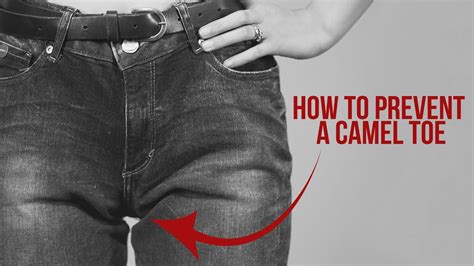 how to prevent a camel toe